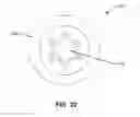 Fig. 50 - Systems and methods for fusing a sacroiliac joint and anchoring an orthopedic appliance