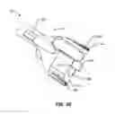Fig. 55 - Systems and methods for fusing a sacroiliac joint and anchoring an orthopedic appliance