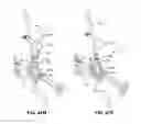 Fig. 72 - Systems and methods for fusing a sacroiliac joint and anchoring an orthopedic appliance