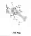 Fig. 74 - Systems and methods for fusing a sacroiliac joint and anchoring an orthopedic appliance