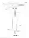 Fig. 78 - Systems and methods for fusing a sacroiliac joint and anchoring an orthopedic appliance