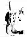 Fig. 82 - Systems and methods for fusing a sacroiliac joint and anchoring an orthopedic appliance