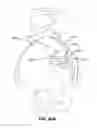 Fig. 85 - Systems and methods for fusing a sacroiliac joint and anchoring an orthopedic appliance
