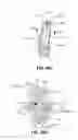 Fig. 87 - Systems and methods for fusing a sacroiliac joint and anchoring an orthopedic appliance