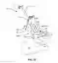 Fig. 95 - Systems and methods for fusing a sacroiliac joint and anchoring an orthopedic appliance