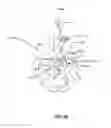 Fig. 96 - Systems and methods for fusing a sacroiliac joint and anchoring an orthopedic appliance