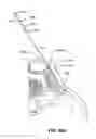 Fig. 98 - Systems and methods for fusing a sacroiliac joint and anchoring an orthopedic appliance