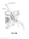 Fig. 99 - Systems and methods for fusing a sacroiliac joint and anchoring an orthopedic appliance