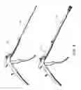 Fig. 05 - Instruments, tools, and methods for presson pedicle screws