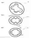 Fig. 06 - Device for fixating a Kirschner wire