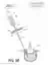 Fig. 07 - Bone treatment systems and methods