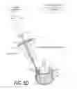 Fig. 09 - Bone treatment systems and methods