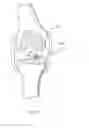 Fig. 08 - Medical ablation system and method of use
