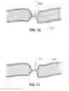 Fig. 08 - VESSEL SEALING FORCEPS