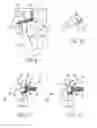 Fig. 06 - Dual step bailout for motorized RF device