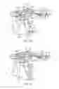 Fig. 07 - Dual step bailout for motorized RF device