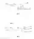 Fig. 02 - Tissue ablation system with energy distribution