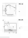 Fig. 03 - Treatment apparatus for a subretinal injection and method for assisting in a subretinal injection