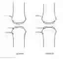 Fig. 02 - Method and node for manufacturing a surgical kit for cartilage repair