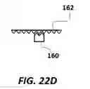 Fig. 68 - Robotic device for image-guided surgery and interventions