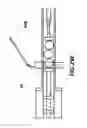 Fig. 86 - Robotic device for image-guided surgery and interventions