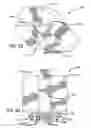 Fig. 07 - METHODS OF HOOK AND PIVOT ELECTRO-MECHANICAL INTERFACE FOR TELEOPERATED SURGICAL ARMS