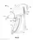 Fig. 04 - Apparatus and method for using a remote control system in surgical procedures