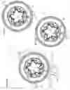 Fig. 03 - System and method for MRI-guided breast interventions