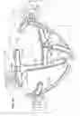 Fig. 10 - System and method for MRI-guided breast interventions