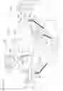Fig. 11 - System and method for MRI-guided breast interventions