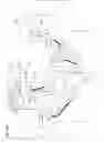 Fig. 13 - System and method for MRI-guided breast interventions