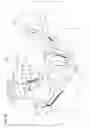 Fig. 14 - System and method for MRI-guided breast interventions