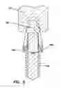 Fig. 06 - Dental implant with interlocking and centering threads
