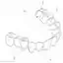 Fig. 01 - Method for producing a dental prosthesis