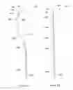 Fig. 07 - Systems and methods for sling delivery and placement