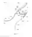 Fig. 14 - Systems and methods for sling delivery and placement