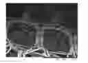 Fig. 01 - Prosthesis comprising a three-dimensional and openworked knit