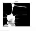 Fig. 14 - Method of producing a 3D subject specific biomimetic nerve conduit