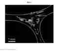 Fig. 15 - Method of producing a 3D subject specific biomimetic nerve conduit