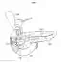 Fig. 02 - ANTIREFLUX STENT
