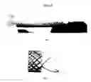 Fig. 06 - ANTIREFLUX STENT