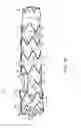 Fig. 03 - Method for aortic branched vessel repair