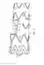 Fig. 04 - Method for aortic branched vessel repair