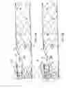 Fig. 05 - Method for aortic branched vessel repair
