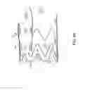 Fig. 07 - Method for aortic branched vessel repair