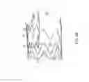 Fig. 08 - Method for aortic branched vessel repair