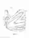 Fig. 13 - Method for aortic branched vessel repair