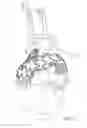 Fig. 14 - Method for aortic branched vessel repair