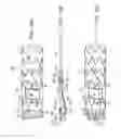 Fig. 16 - Method for aortic branched vessel repair