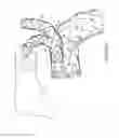 Fig. 28 - Method for aortic branched vessel repair